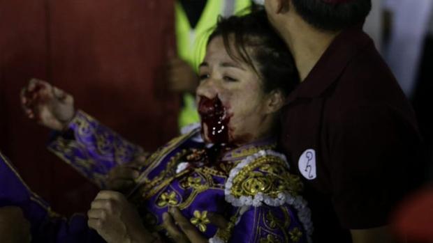 Hilda Tenorio, con la cara ensangrentada tras la cornada en la boca