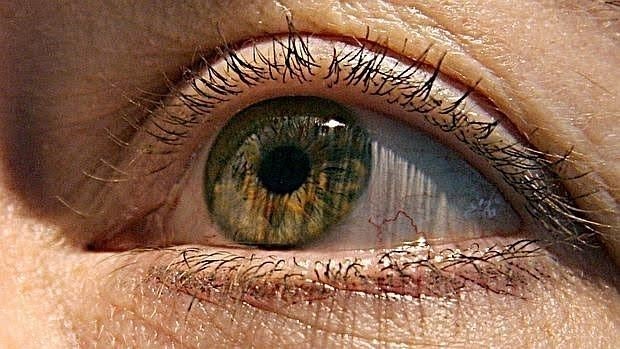 Persona afectada por glaucoma