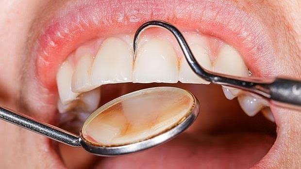 Una buena salud bucodental es clave para una buena salud general