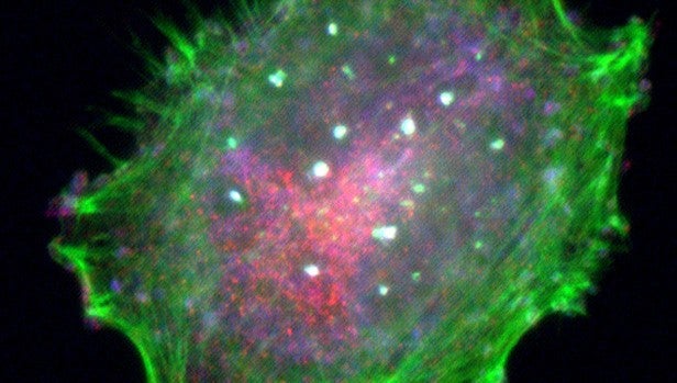 Célula de melanoma