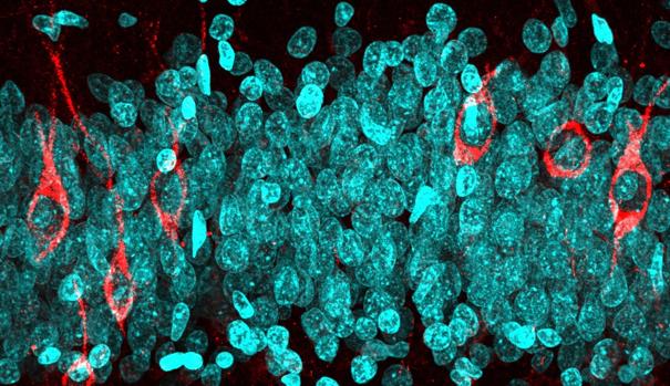 Neuronas inmaduras (rojo) y neuronas maduras (azul) en el giro dentado de un sujeto cognitivamente sano de 68 años de edad.
