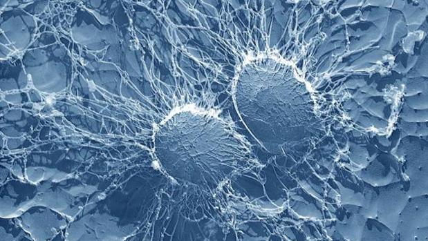 'Staphylococcus aureus' es una superbacteria que produce una toxina cuya función es facilitar la infección, pero también puede matar otras bacterias presentes en nuestro cuerpo